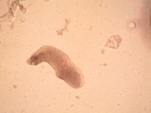 fire amoeba